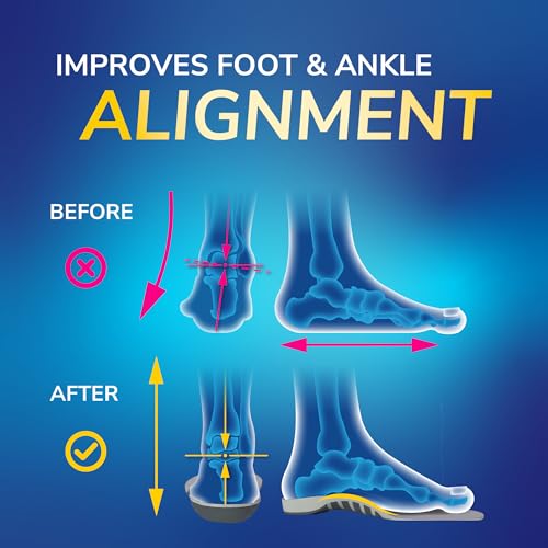 Dr. Scholl’s Flat Feet Support Insoles for Women, Size 6-10: Immediately Relieve Discomfort, Cradle Feet & Improve Ankle Alignment, Due to Overpronation,Low & Fallen Arches, Reduces Lower Body Stress