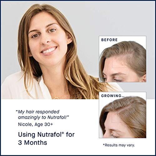 Hair Loss Thinning Supplement - Women Hair Vitamin for Thicker Healthier Hair