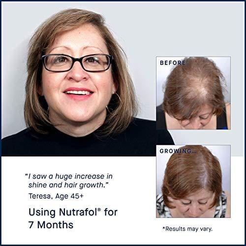 Hair Loss Thinning Supplement - Women Hair Vitamin for Thicker Healthier Hair