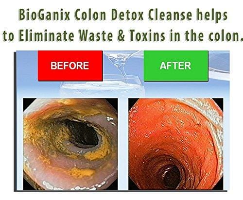 BioGanix Colon Detox Cleanse & Weight Loss Pills (120 Capsules) Quick 15-Day Ultimate Intensive Herbal Supplement Formula - Total Cleansing Flushes Toxins & Eliminates Waste