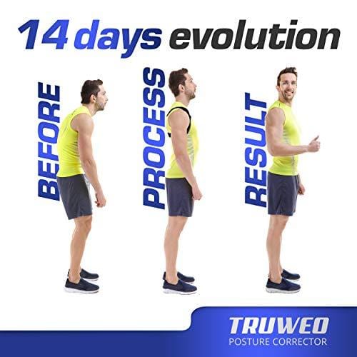 Posture Corrector For Men And Women - USA Designed Adjustable Upper Back Brace For Clavicle Support and Providing Pain Relief From Neck, Back and Shoulder (Universal) - Ultra Pickleball